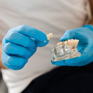 closeup of dentist hands holding and showing a model for dental implants